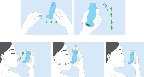 how to use steroid inhaler